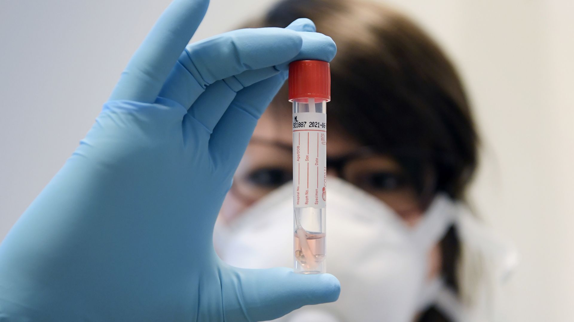 Frau mit Mundschutz hält Teströhrchen.